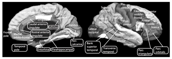 Figure 2. The cortex areas relevant for this study (after graphical materials of Hagmann et al., 2008; with permission of Creative Commons Attribution License). Kozlovskiy S. A., Shirenova S. D., Neklyudova A. K., Vartanov A. V.(2017). Psychology in Russia: State of the Art, 10 (3), 218-230