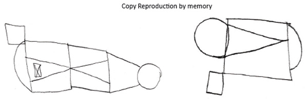 Figure 1. Task “Copy and reproduction by memory of Rey figure” before rehabilitation. Solovieva Yu., Quintanar L. (2018). Psychology in Russia: State of the Art, 11 (1), 137-150.